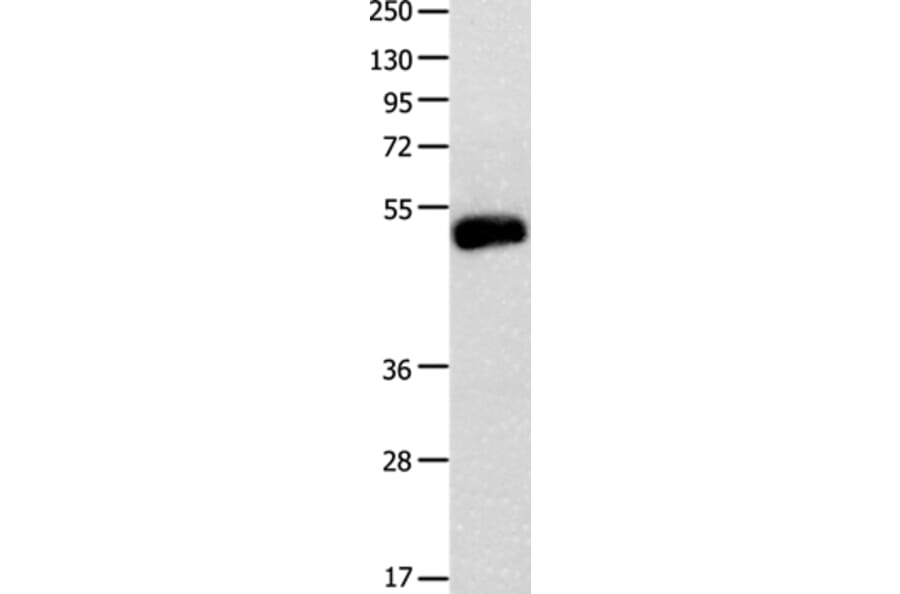BMP4 Antibody from Signalway Antibody (35652) - Antibodies.com