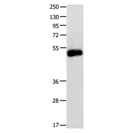 BMP4 Antibody from Signalway Antibody (35652) - Antibodies.com