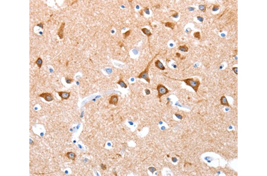 Immunohistochemistry - BMP4 Antibody from Signalway Antibody (35652) - Antibodies.com
