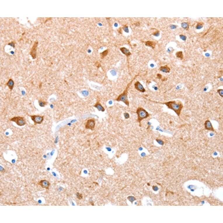 Immunohistochemistry - BMP4 Antibody from Signalway Antibody (35652) - Antibodies.com