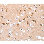 Immunohistochemistry - BMP4 Antibody from Signalway Antibody (35652) - Antibodies.com