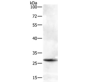 BTG3 Antibody from Signalway Antibody (35655) - Antibodies.com