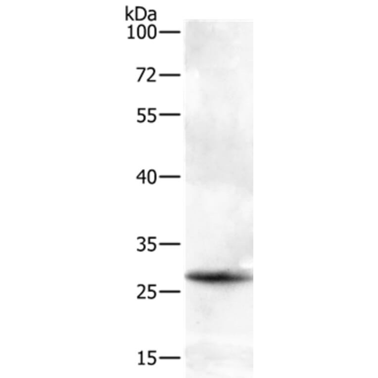 BTG3 Antibody from Signalway Antibody (35655) - Antibodies.com