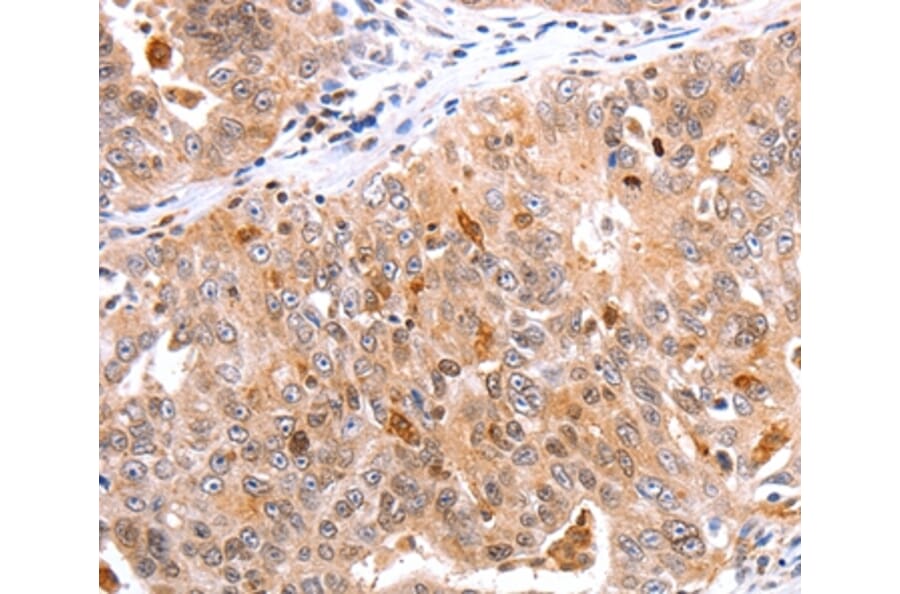 Immunohistochemistry - BTG3 Antibody from Signalway Antibody (35655) - Antibodies.com