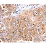 Immunohistochemistry - BTG3 Antibody from Signalway Antibody (35655) - Antibodies.com