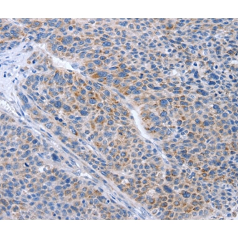 Immunohistochemistry - BTG2 Antibody from Signalway Antibody (35656) - Antibodies.com