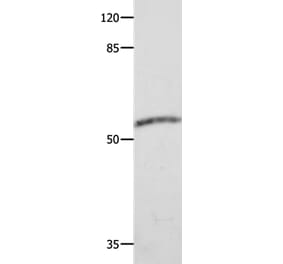 CAP2 Antibody from Signalway Antibody (35661) - Antibodies.com