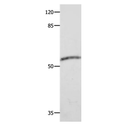 CAP2 Antibody from Signalway Antibody (35661) - Antibodies.com