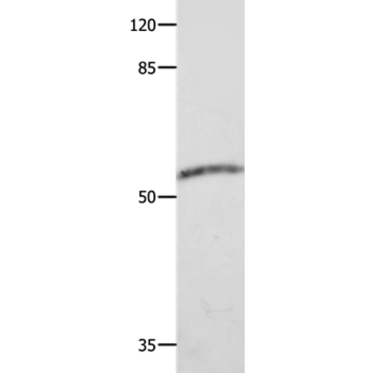 CAP2 Antibody from Signalway Antibody (35661) - Antibodies.com