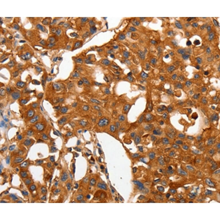 Immunohistochemistry - CAP2 Antibody from Signalway Antibody (35661) - Antibodies.com
