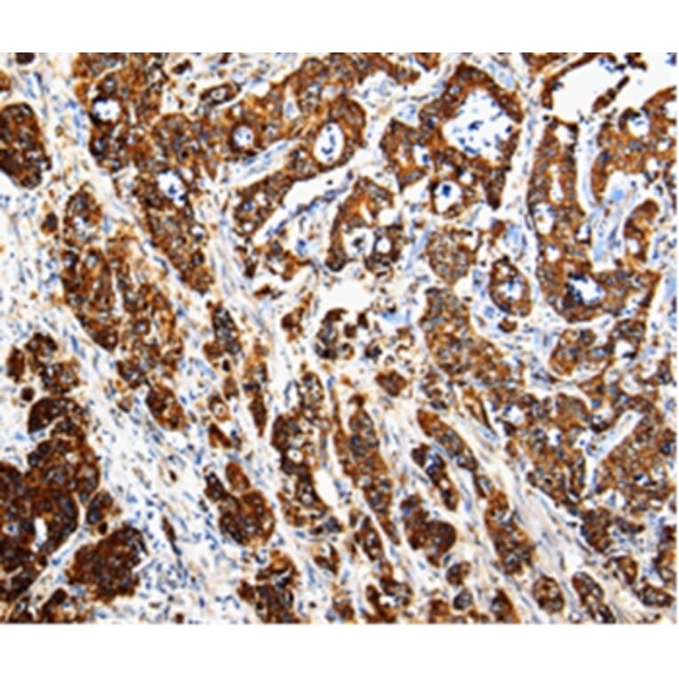 Immunohistochemistry - CTSE Antibody from Signalway Antibody (35666) - Antibodies.com