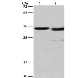 CTSL Antibody from Signalway Antibody (35668) - Antibodies.com
