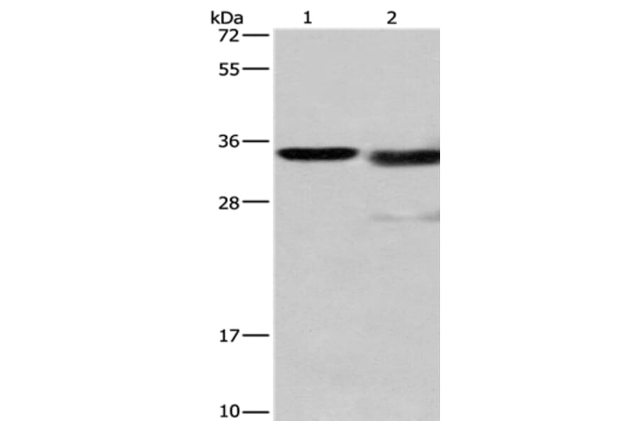 CTSL Antibody from Signalway Antibody (35668) - Antibodies.com