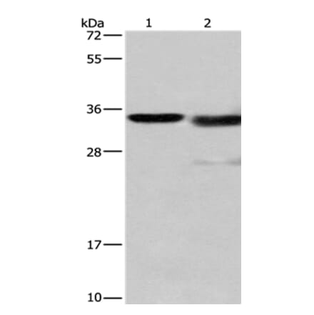 CTSL Antibody from Signalway Antibody (35668) - Antibodies.com