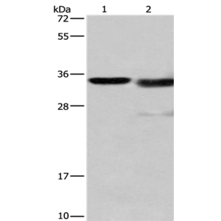 CTSL Antibody from Signalway Antibody (35668) - Antibodies.com