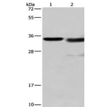 CTSL Antibody from Signalway Antibody (35668) - Antibodies.com