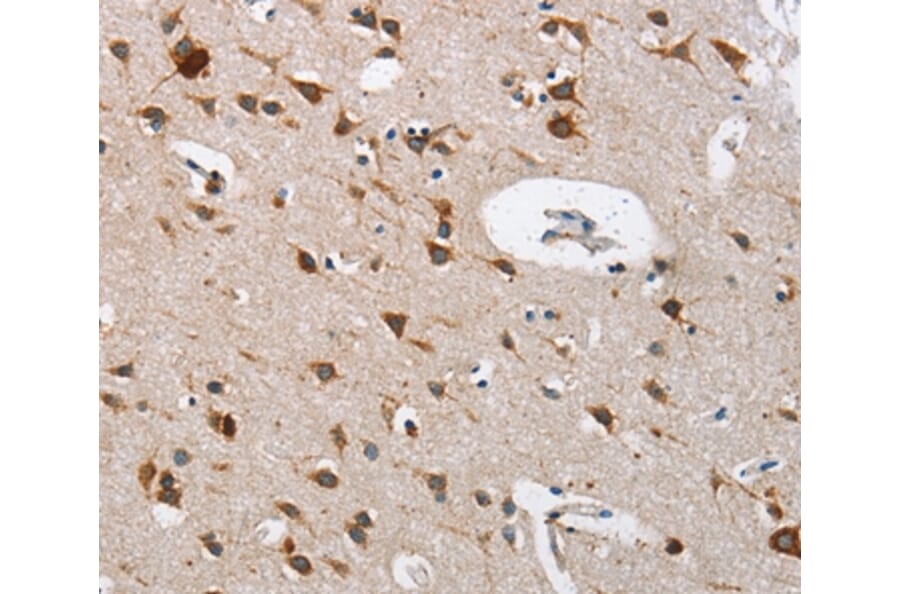 Immunohistochemistry - CTSL Antibody from Signalway Antibody (35668) - Antibodies.com