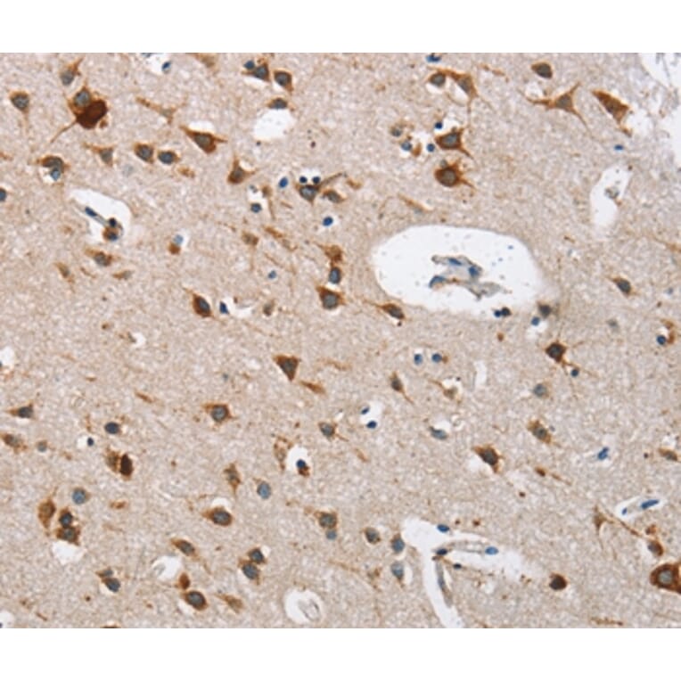 Immunohistochemistry - CTSL Antibody from Signalway Antibody (35668) - Antibodies.com