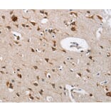 Immunohistochemistry - CTSL Antibody from Signalway Antibody (35668) - Antibodies.com