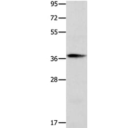 CTSV Antibody from Signalway Antibody (35669) - Antibodies.com