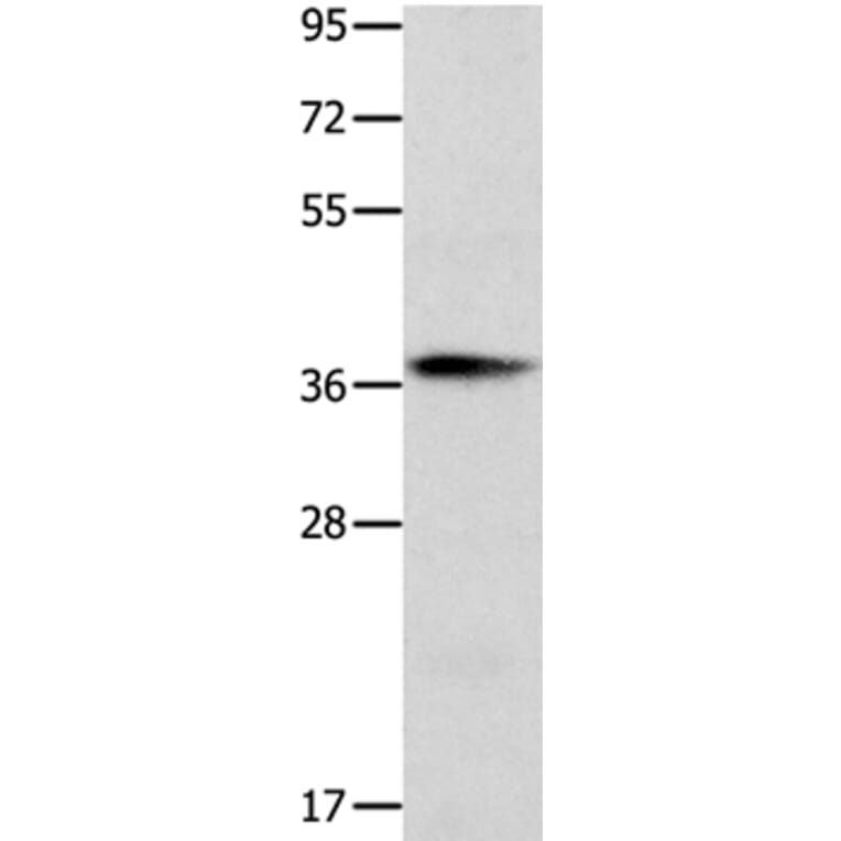 CTSV Antibody from Signalway Antibody (35669) - Antibodies.com