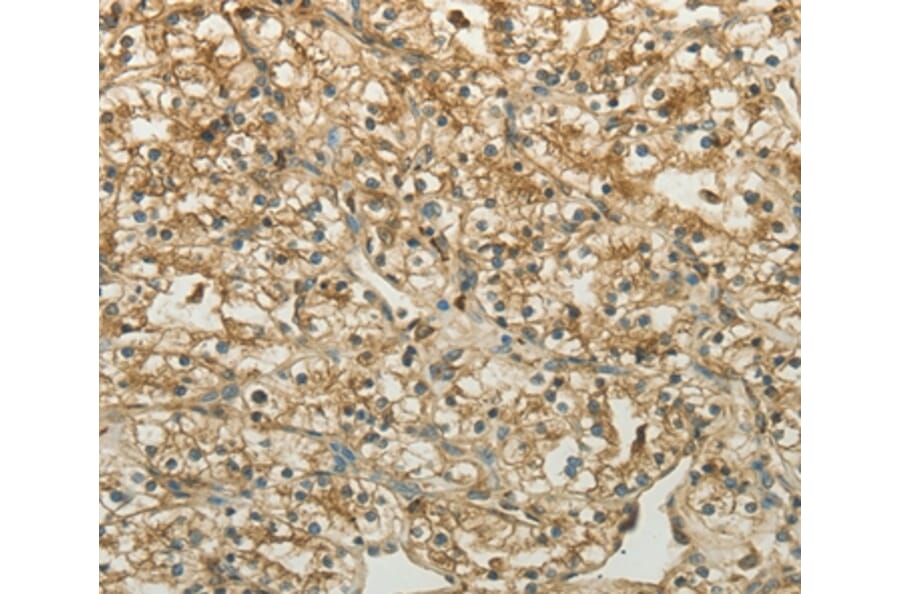 Immunohistochemistry - CTSV Antibody from Signalway Antibody (35669) - Antibodies.com