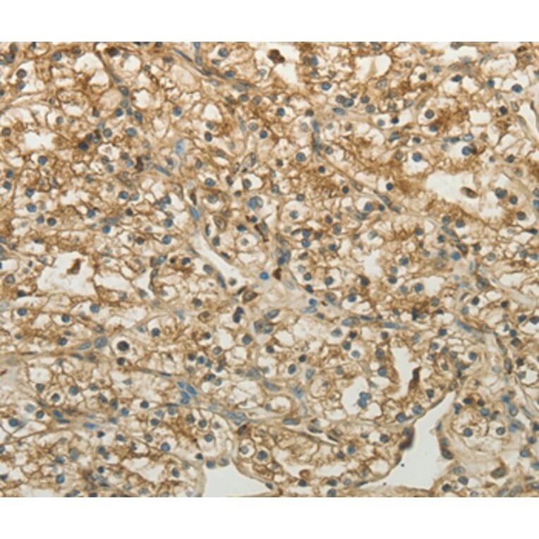 Immunohistochemistry - CTSV Antibody from Signalway Antibody (35669) - Antibodies.com