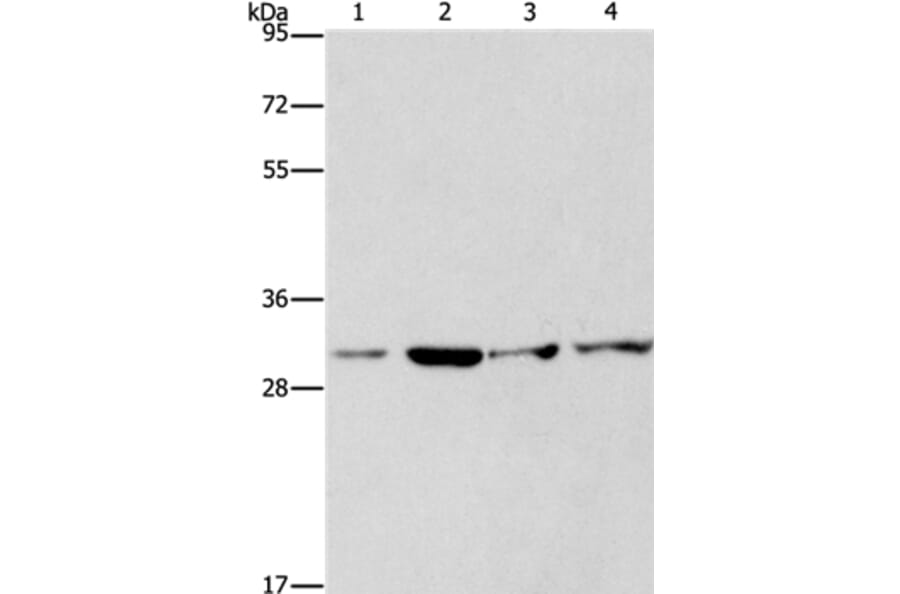 CDK2 Antibody from Signalway Antibody (35676) - Antibodies.com