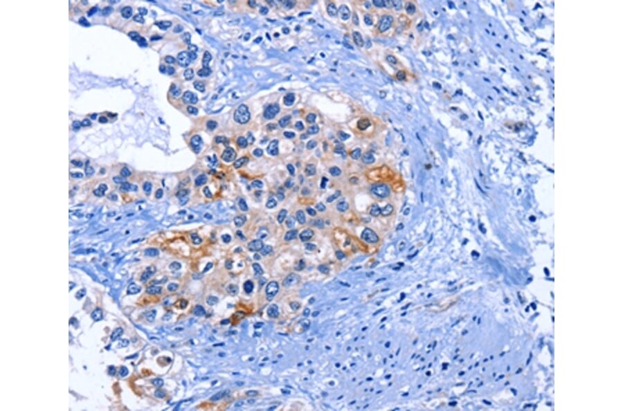 Immunohistochemistry - CDK2 Antibody from Signalway Antibody (35676) - Antibodies.com