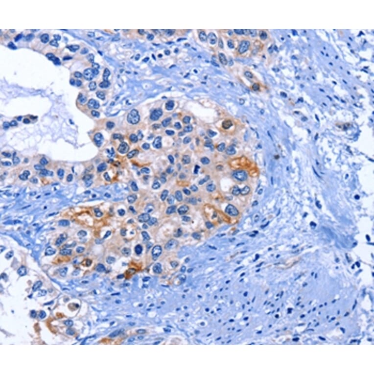 Immunohistochemistry - CDK2 Antibody from Signalway Antibody (35676) - Antibodies.com