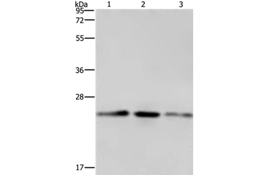 EMC8 Antibody from Signalway Antibody (35694) - Antibodies.com