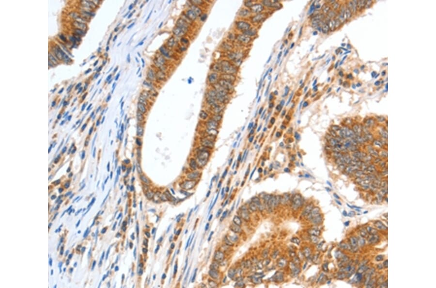 Immunohistochemistry - CCNF Antibody from Signalway Antibody (35703) - Antibodies.com