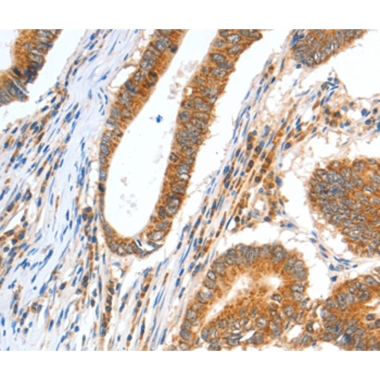 Immunohistochemistry - CCNF Antibody from Signalway Antibody (35703) - Antibodies.com