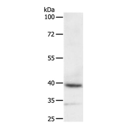 DTX3 Antibody from Signalway Antibody (35712) - Antibodies.com