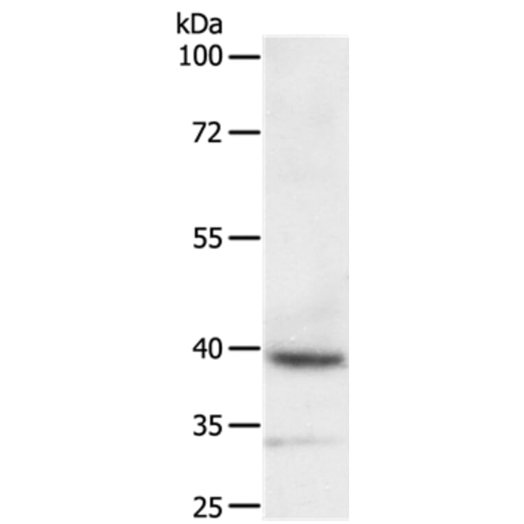 DTX3 Antibody from Signalway Antibody (35712) - Antibodies.com