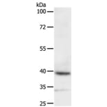 DTX3 Antibody from Signalway Antibody (35712) - Antibodies.com