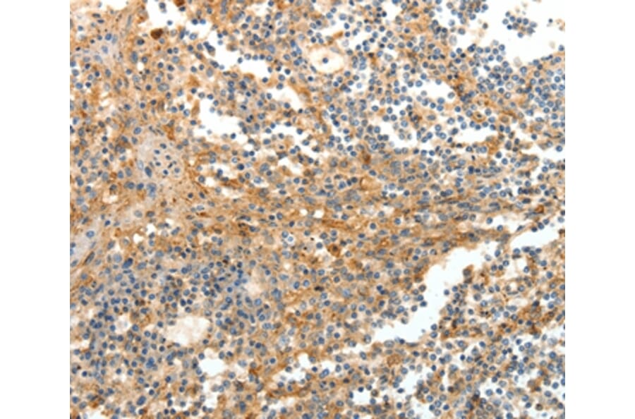 Immunohistochemistry - DTX3 Antibody from Signalway Antibody (35712) - Antibodies.com