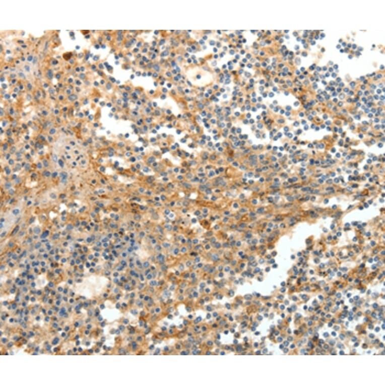 Immunohistochemistry - DTX3 Antibody from Signalway Antibody (35712) - Antibodies.com