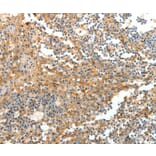 Immunohistochemistry - DTX3 Antibody from Signalway Antibody (35712) - Antibodies.com