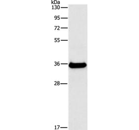 FGL1 Antibody from Signalway Antibody (35738) - Antibodies.com