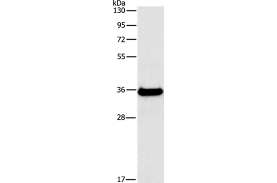 FGL1 Antibody from Signalway Antibody (35738) - Antibodies.com