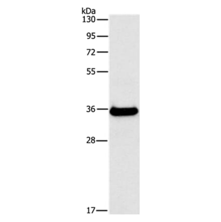 FGL1 Antibody from Signalway Antibody (35738) - Antibodies.com