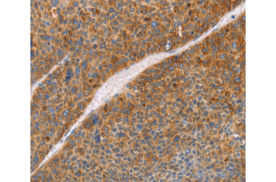 Immunohistochemistry - FGL1 Antibody from Signalway Antibody (35738) - Antibodies.com