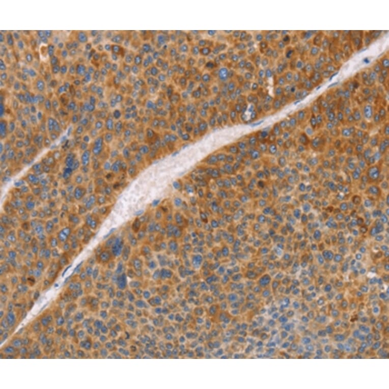 Immunohistochemistry - FGL1 Antibody from Signalway Antibody (35738) - Antibodies.com