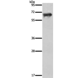 FSHR Antibody from Signalway Antibody (35743) - Antibodies.com