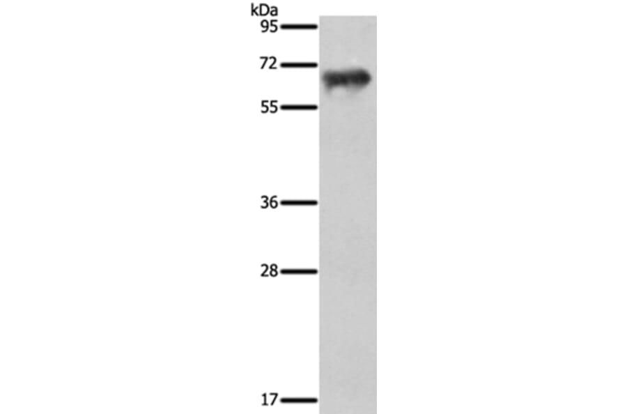 FSHR Antibody from Signalway Antibody (35743) - Antibodies.com