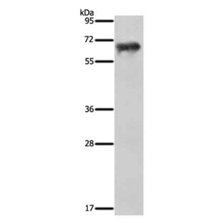 FSHR Antibody from Signalway Antibody (35743) - Antibodies.com
