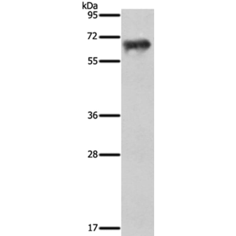 FSHR Antibody from Signalway Antibody (35743) - Antibodies.com