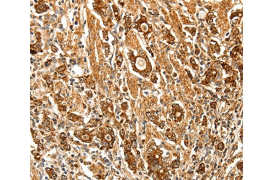 Immunohistochemistry - FSHR Antibody from Signalway Antibody (35743) - Antibodies.com