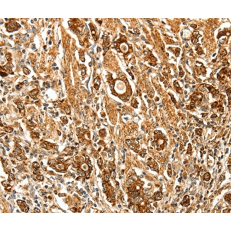 Immunohistochemistry - FSHR Antibody from Signalway Antibody (35743) - Antibodies.com